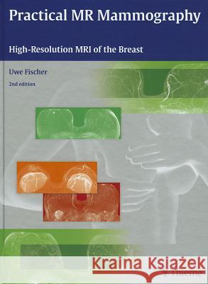Practical MR Mammography : High-Resolution MRI of the Breast Uwe Fischer 9783131320322 0