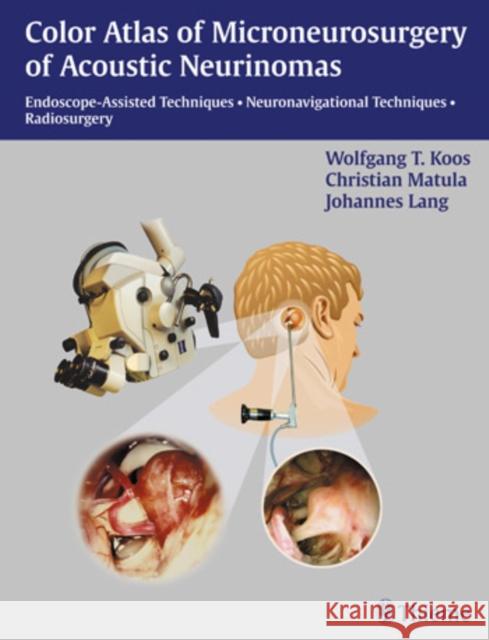 Paket Koos Microneurosurgery Koos, Wolfgang 9783131364623 Thieme Publishing Group