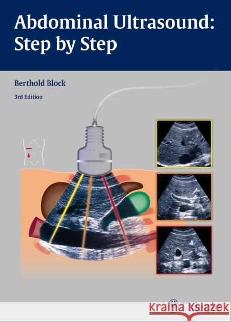 Abdominal Ultrasound: Step by Step Berthold Block 9783131383631