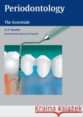 Periodontology Compendium: The Essentials Hans-Peter Mueller   9783131383716