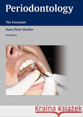 Periodontology: The Essentials Müller, Hans-Peter 9783131383723