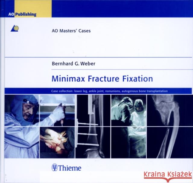 Minimax Fracture Fixation: Ao Masters' Cases Weber, Bernhard G. 9783131392718