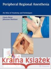 Peripheral Regional Anesthesia: An Atlas of Anatomy and Techniques Gisela Meier Johannes Buettner  9783131397928 Thieme Publishing Group