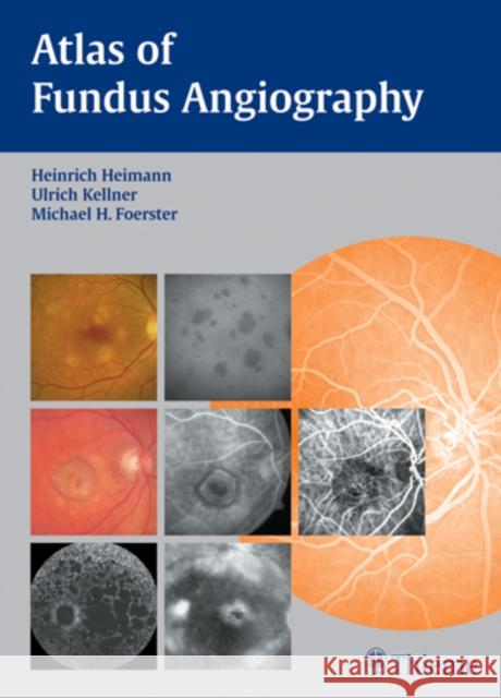 Atlas of Fundus Angiography Heimann, Heinrich Kellner, Ulrich Foerster, Michael H. 9783131405517 Thieme, Stuttgart