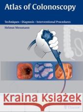 Atlas of Colonscopy: Examination, Techniques, Diagnosis, Interventional Procedure Messmann, Helmut    9783131405715