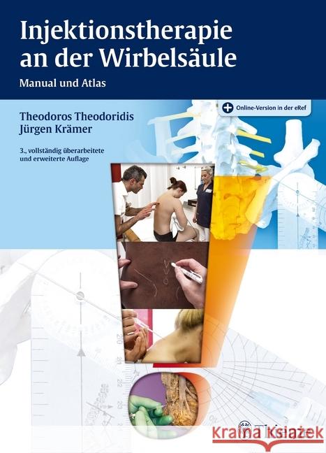 Injektionstherapie an der Wirbelsäule : Manual und Atlas. Plus Online-Version in der eRef Theodoridis, Theodoros; Krämer, Jürgen 9783131410436 Thieme, Stuttgart