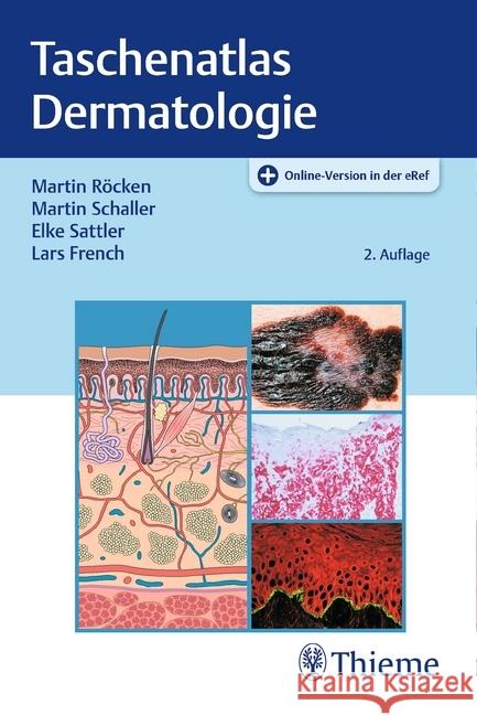 Taschenatlas Dermatologie French, Lars 9783131425225