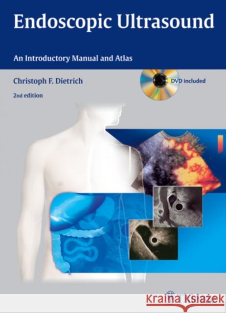 Endoscopic Ultrasound: An Introductory Manual and Atlas Dietrich, Christoph Frank 9783131431523 Thieme Medical Publishers