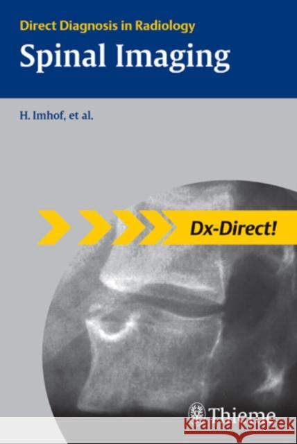 Spinal Imaging: Direct Diagnosis in Radiology Imhof, Herwig 9783131440716 Thieme Publishing Group