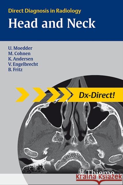 Head and Neck Imaging: Direct Diagnosis in Radiology Mödder, Ulrich 9783131440815