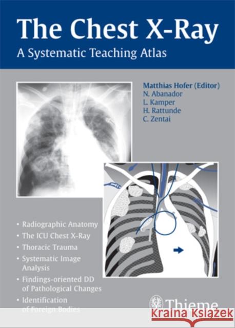 The Chest X-Ray: A Systematic Teaching Atlas Hofer, Matthias 9783131442116 Thieme Publishing Group