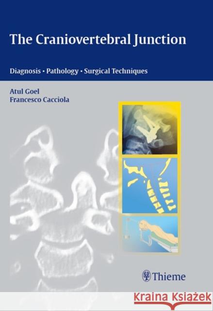 The Craniovertebral Junction: Diagnosis - Pathology - Surgical Techniques Goel, Atul 9783131455819 Thieme Medical Publishers