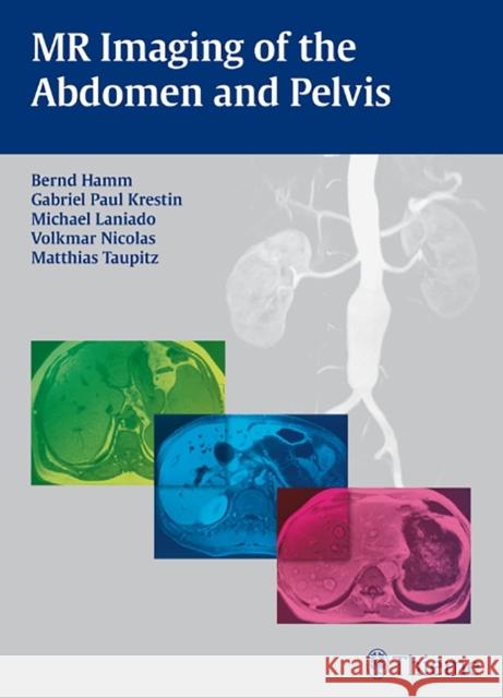 MR Imaging of the Abdomen and Pelvis Bernd Hamm Gabriel Krestin Michael Laniado 9783131455918 Thieme Medical Publishers