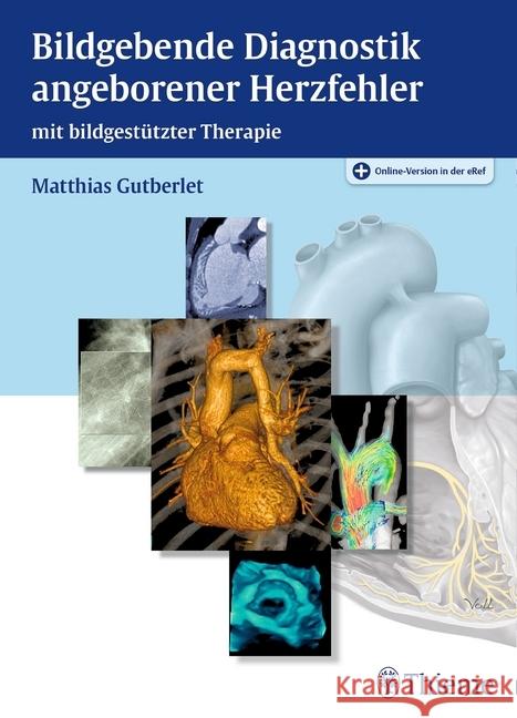 Bildgebende Diagnostik angeborener Herzfehler : mit bildgestützter Therapie. Online-Version in der eRef Gutberlet, Matthias 9783131460615