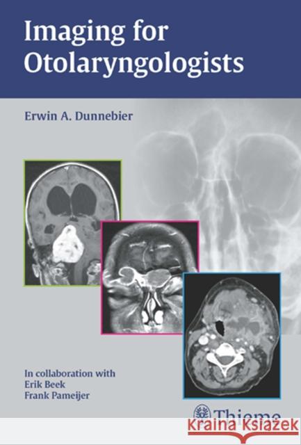 Imaging for Otolaryngologists Dunnebier, Erwin A. 9783131463319 