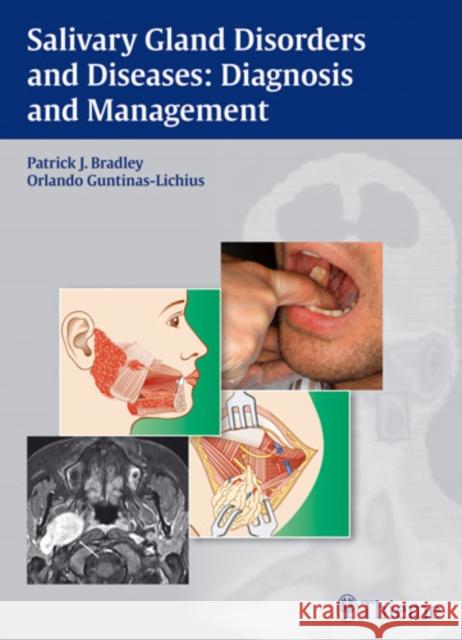 Salivary Gland Disorders and Diseases:: Diagnosis and Management Bradley, Patrick J. 9783131464910 Thieme Medical Publishers