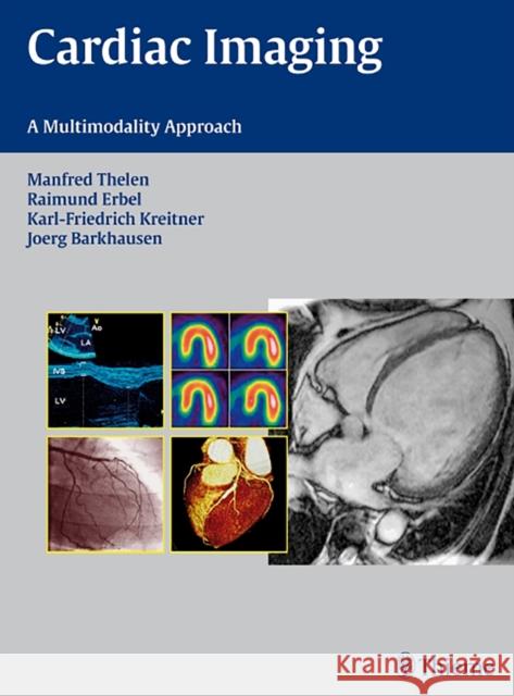 Cardiac Imaging: A Multimodality Approach Barkhausen, Jörg 9783131477811