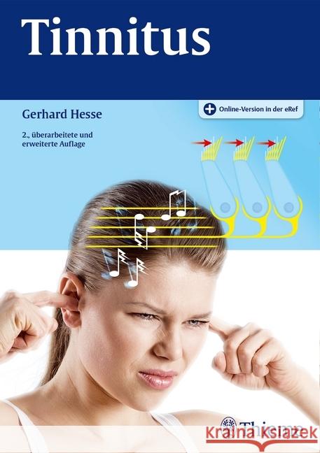 Tinnitus Hesse, Gerhard 9783131478023 Thieme, Stuttgart