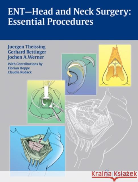 ENT Head and Neck Surgery: Essential Procedures Jochen A. Werner 9783131486219