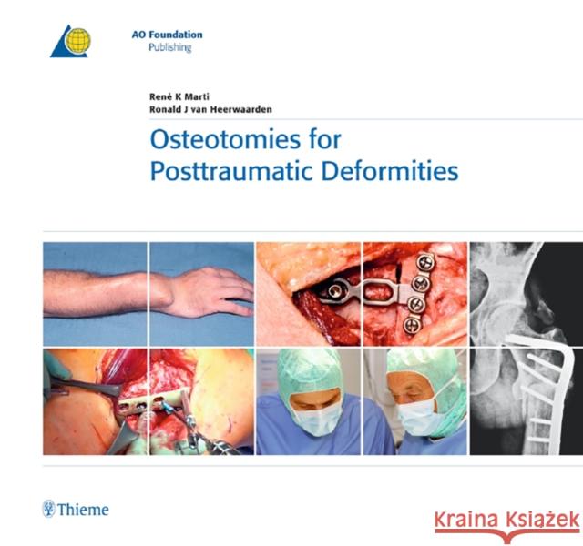 Osteotomies for Posttraumatic Deformities Marti 9783131486714 Georg Thieme Verlag