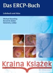 Das ERCP-Buch, m. DVD-ROM : Lehrbuch und Atlas Keymling, Michael; Kohler, Bernd M.; Lübke, Heinrich J. 9783131493019