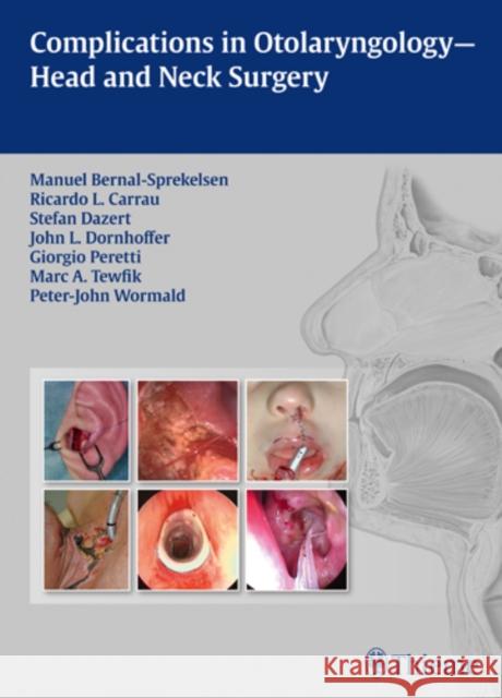 Complications in Otolaryngology - Head and Neck Surgery Manuel Bernal-Sprekelsen 9783131605313 Thieme Medical Publishers