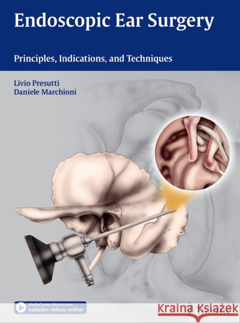 Endoscopic Ear Surgery: Principles, Indications, and Techniques Presutti, Livio 9783131630414