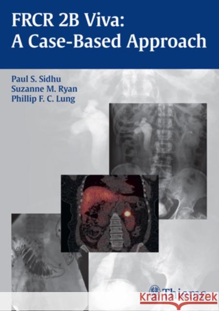 FRCR 2B Viva: A Case-Based Approach Sidhu, Paul S. 9783131662910