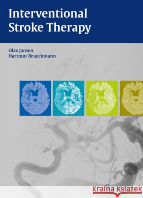 Interventional Stroke Therapy Olav Jansen Hartmut Brueckmann 9783131699213 Thieme Medical Publishers