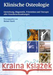 Klinische Osteologie : Entstehung, Diagnostik, Prävention und Therapie aller Knochenerkrankungen Bartl, Reiner 9783131701619