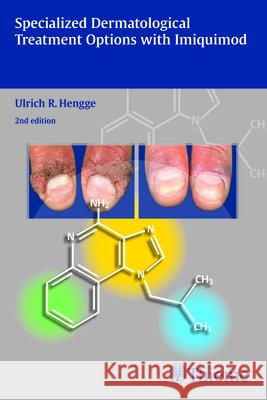 Specialized Dermatological Treatment Optinos with Imiquimod Hengge, Ulrich R. 9783131706928 Thieme, Stuttgart