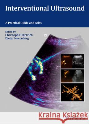 Interventional Ultrasound: A Practical Guide and Atlas Dietrich, Christoph Frank 9783131708212 Thieme Medical Publishers