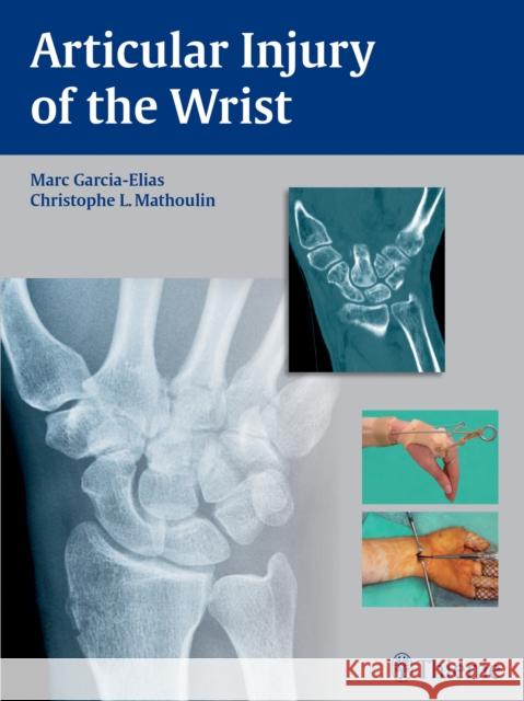 Articular Injury of the Wrist: Fessh 2014 Instructional Course Book Garcia-Elias, Marc 9783131746214 Thieme Medical Publishers