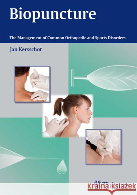 Biopuncture: The Management of Common Orthopedic and Sports Disorders Kersschot, Jan 9783131752215 Thieme Medical Publishers