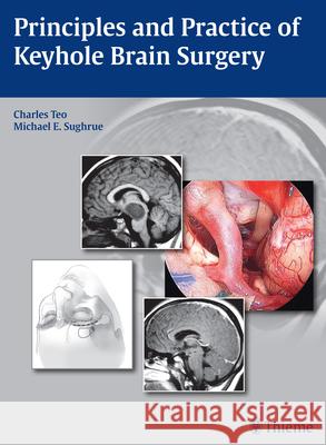 Principles and Practice of Keyhole Brain Surgery Charles Teo Michael E. Sughrue 9783131758514 Thieme Medical Publishers