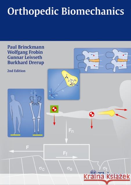 Orthopedic Biomechanics Paul Brinckmann W Frobin Gunnar Leivseth 9783131768223 Thieme Publishing Group