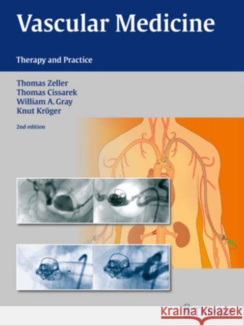 Vascular Medicine: Therapy and Practice Zeller, Thomas 9783131768414 Thieme Medical Publishers