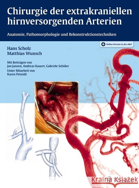 Chirurgie der extrakraniellen hirnversorgenden Arterien : Anatomie, Pathomorphologie und Rekonstruktionstechniken. Plus Online-Version in der eRef Scholz, Hans; Wunsch, Matthias 9783131772619