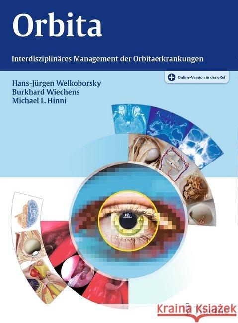 Orbita : Interdisziplinäres Management der Orbitaerkrankungen. Plus Online-Version in der eRef Welkoborsky, Hans-Jürgen; Wiechens, Burkhard; Hinni, Michael L. 9783131773319