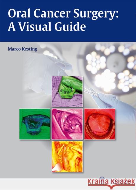 Oral Cancer Surgery: A Visual Guide Kesting, Marco 9783131994011