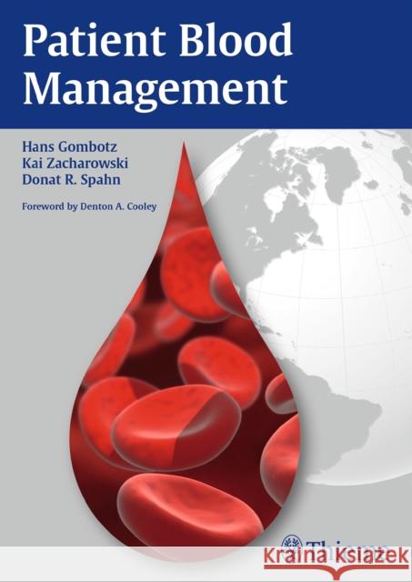 Patient Blood Management Gombotz, Hans 9783132004412 Not Avail