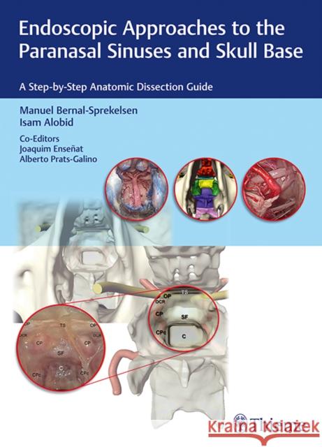 Endoscopic Approaches to the Paranasal Sinuses and Skull Base: A Step-By-Step Anatomic Dissection Guide Bernal-Sprekelsen, Manuel 9783132018815 Tps