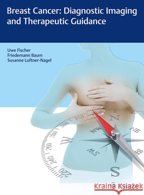 Breast Cancer: Diagnostic Imaging and Therapeutic Guidance Uwe Fischer Friedemann Baum Susanne Luftner-Nagel 9783132019317 Thieme Medical Publishers