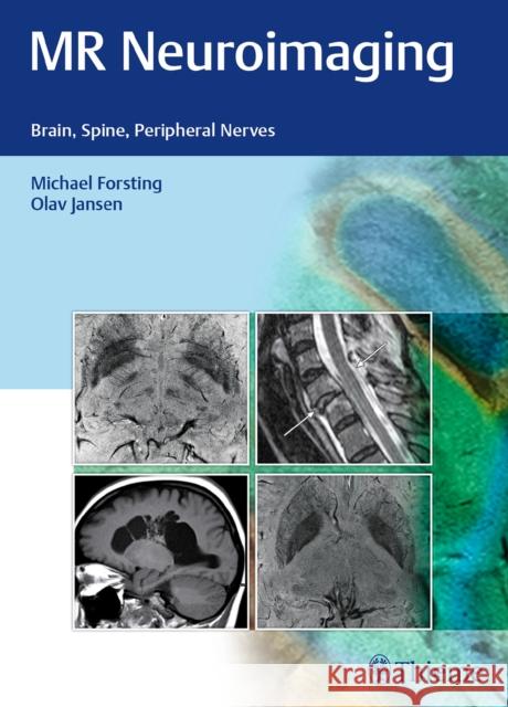 MR Neuroimaging: Brain, Spine, Peripheral Nerves Forsting, Michael 9783132026810 Tps