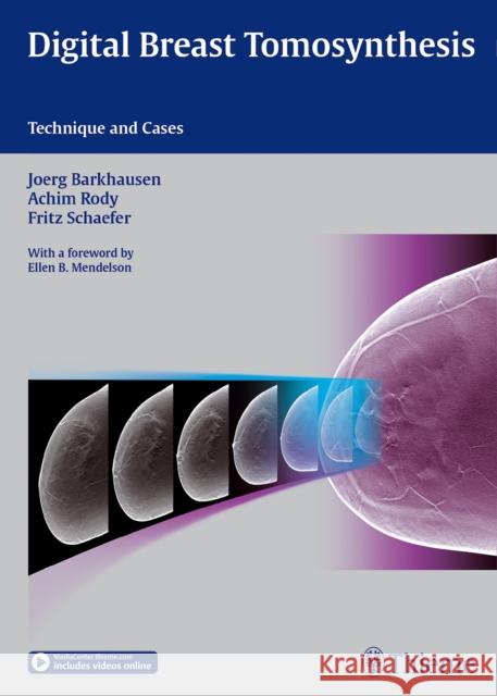 Digital Breast Tomosynthesis: Technique and Cases Barkhausen, Jörg 9783132031616