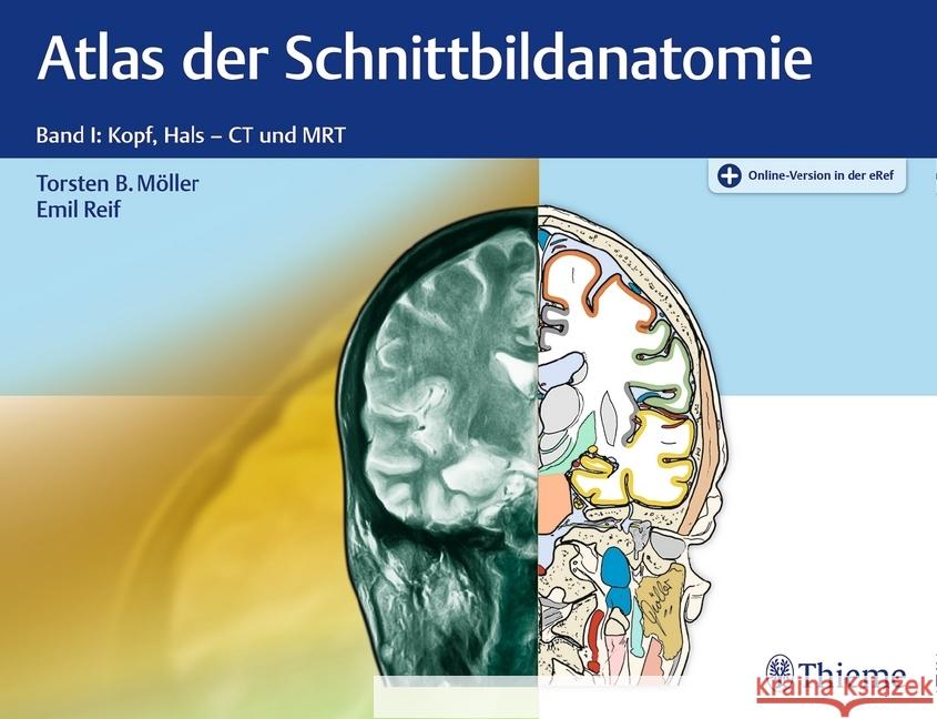 Atlas der Schnittbildanatomie. Bd.1 : Kopf, Hals - CT und MRT. Plus Online-Version in der eRef Möller, Torsten B.; Reif, Emil 9783132032217
