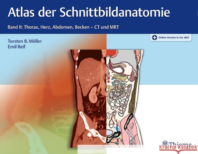 Atlas der Schnittbildanatomie. Bd.2 : Thorax, Herz, Abdomen, Becken. Besteht aus: 1 Buch, 1 E-Book Möller, Torsten B.; Reif, Emil 9783132032514