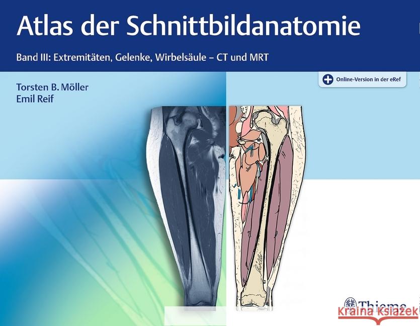 Atlas der Schnittbildanatomie. Bd.3 : Extremitäten, Gelenke und Wirbelsäule - CT und MRT. Plus Online-Version in der eRef Möller, Torsten B.; Reif, Emil 9783132032811