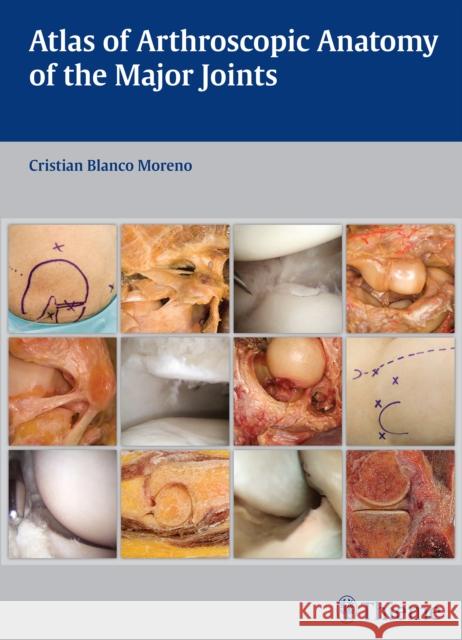 Atlas of Arthroscopic Anatomy of the Major Joints Blanco Moreno, Cristian 9783132037915 Thieme Medical Publishers