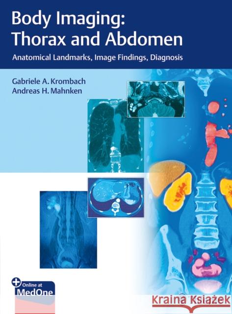 Body Imaging: Thorax and Abdomen: Anatomical Landmarks, Image Findings, Diagnosis Krombach, Gabriele A. 9783132054110 Thieme Medical Publishers
